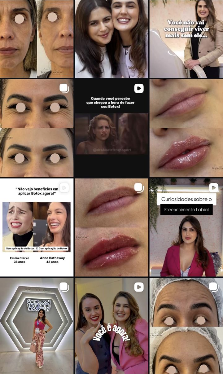 Grade do Instagram da Dra. Beatriz Rapoport com posts de resultados, reels educativos e fotos da doutora